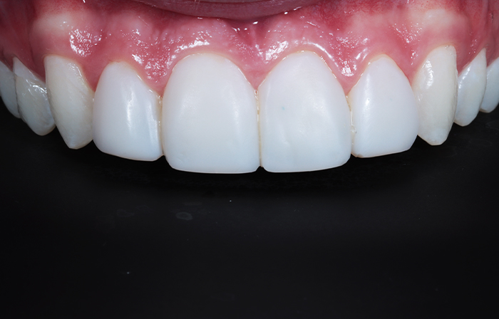 After - Dr Ayesha Ali