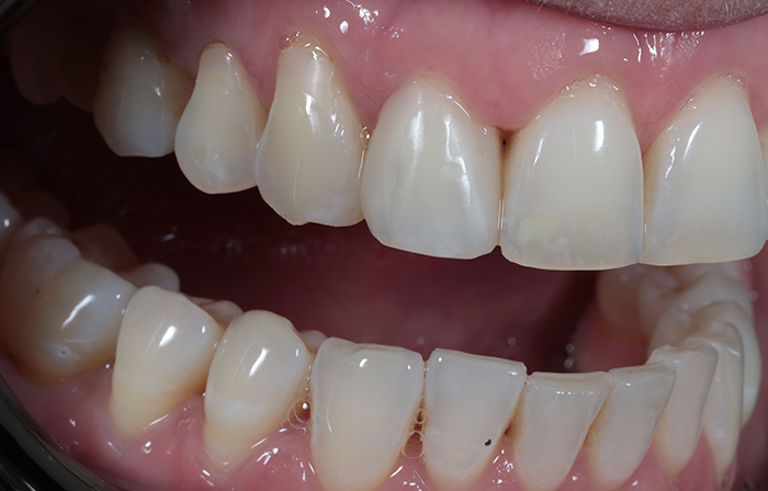 After - Dr Ayesha Ali