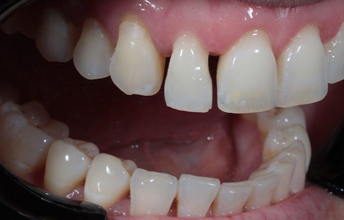 Before - Dr Ayesha Ali