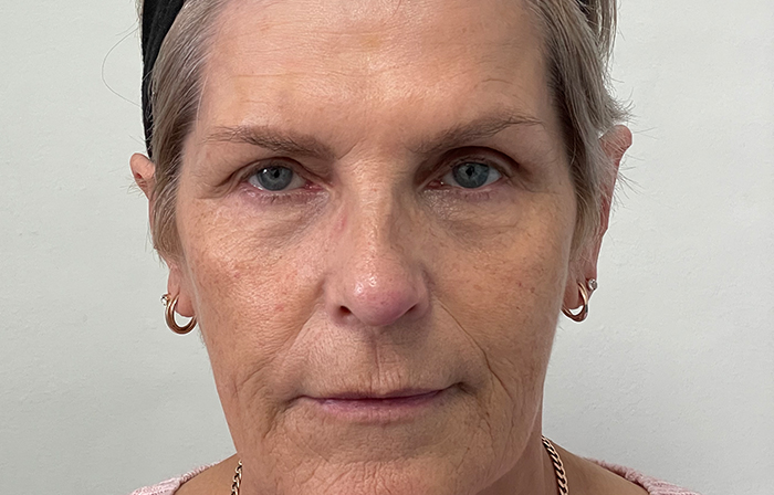 After - Dr Ayesha Ali