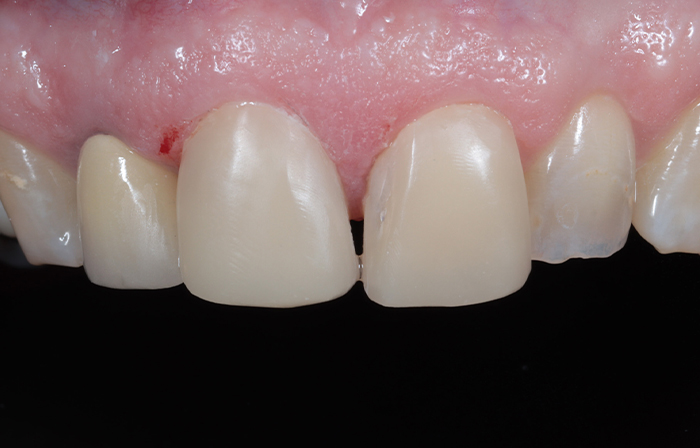 After - Dr Ayesha Ali