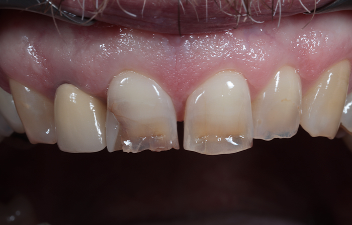 Before - Dr Ayesha Ali