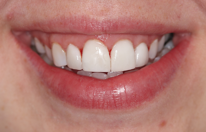 After - Dr Ayesha Ali