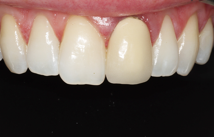 After - Dr Ayesha Ali