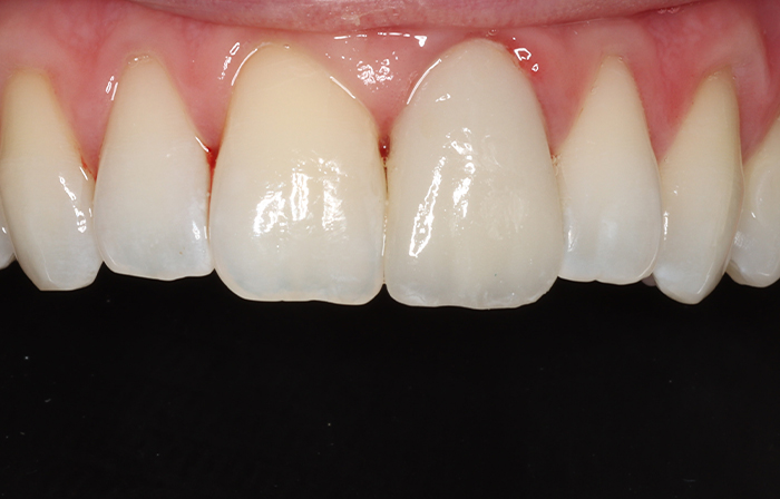 Before - Dr Ayesha Ali