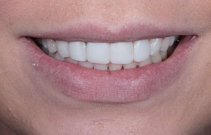 After - Dr Ayesha Ali