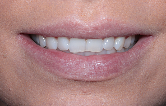 Before - Dr Ayesha Ali