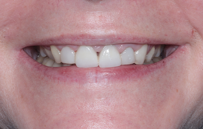 After - Dr Ayesha Ali