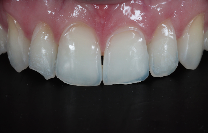 Before - Dr Ayesha Ali